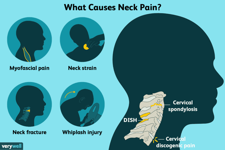 Cervical Pain